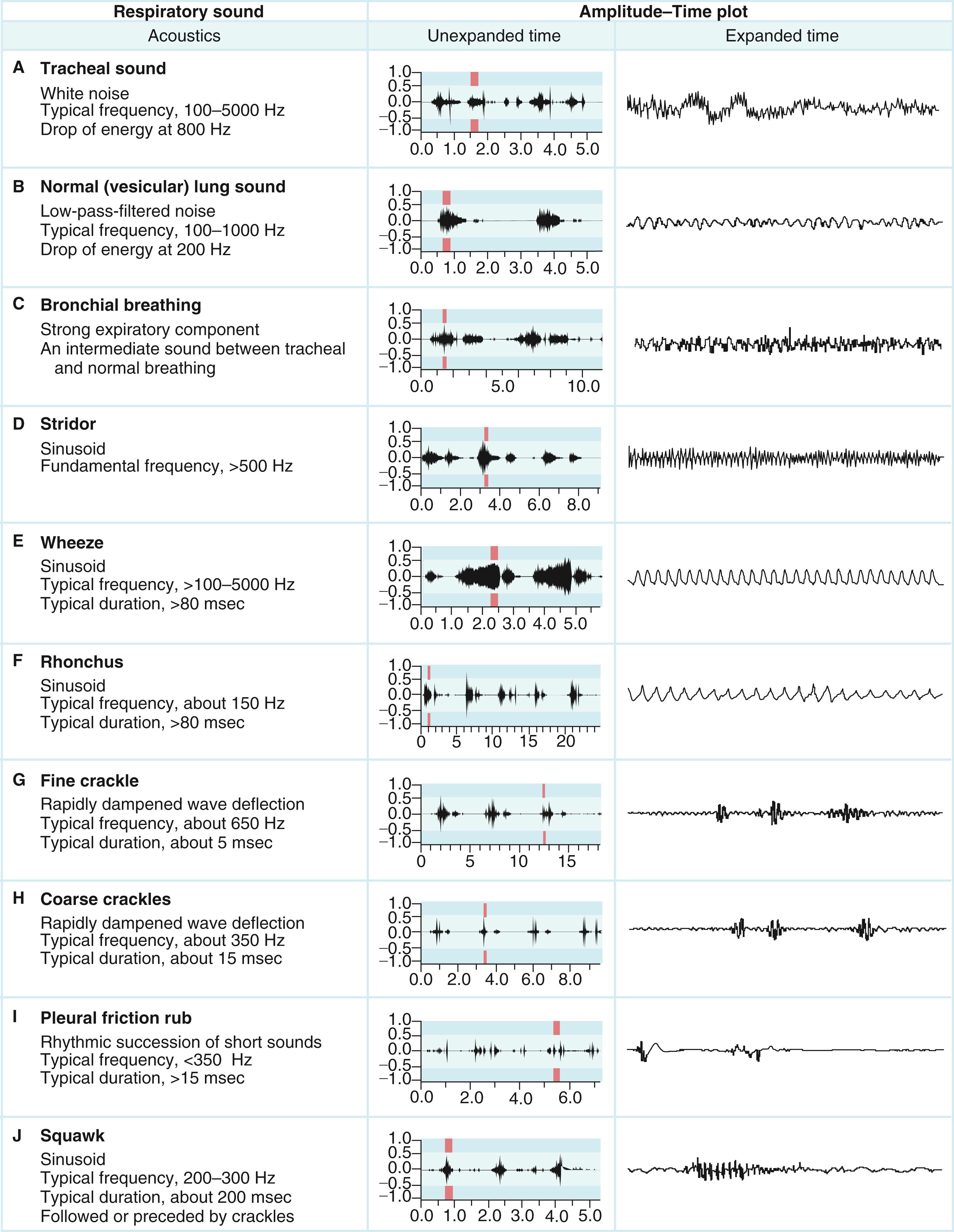 FIGURE 13.2, Respiratory sounds and the acoustic waveforms.