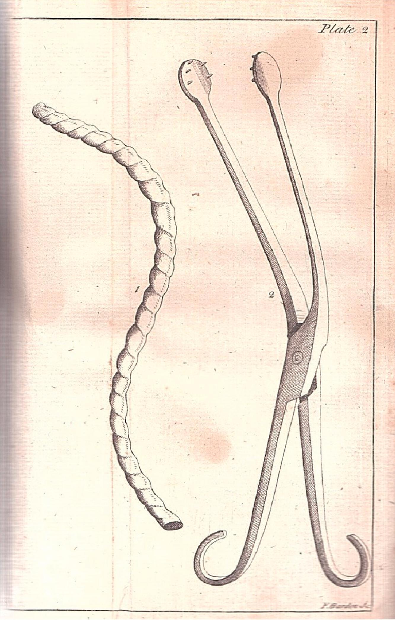 Fig. 17.1, Benjamin Pugh’s air pipe. (From Pugh, B. A Treatise of Midwifery. J. Buckland; 1754.