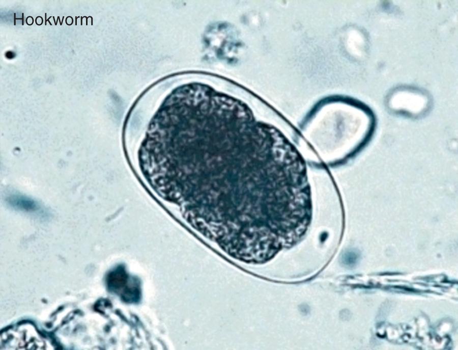 Fig. 318.3, Soil-transmitted hookworm helminth eggs.