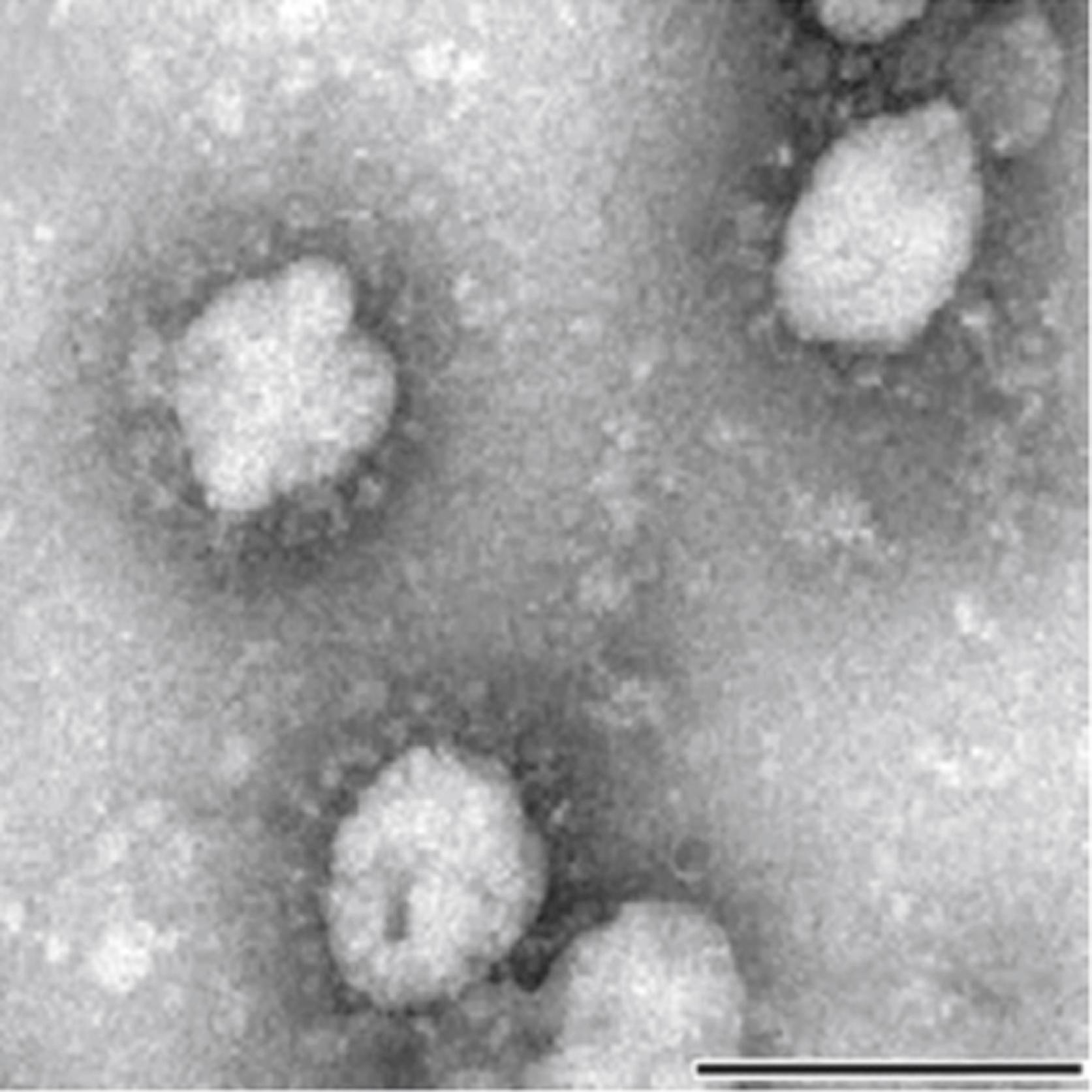 FIGURE 222.1, Negative-contrast electron micrograph of severe acute respiratory syndrome coronaviruses shows the typical crown-like spike proteins on the surface of the coronavirus particles (bar = 100 nm).