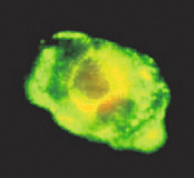 Fig. 80.10, Direct fluorescent antibody assay.