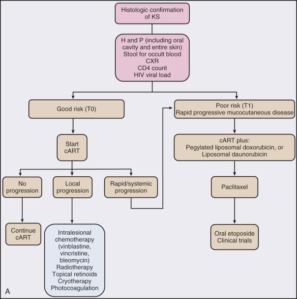 Figure 62.2, Algorithms for management of (A) AIDS-associated Kaposi sarcoma (KS) and (B) HIV-associated lymphoma. cART, Combination antiretroviral therapy; CHOP, cyclophosphamide, doxorubicin, vincristine, prednisone; CNS, central nervous system; CODOX-M/IVAC, cyclophosphamide, vincristine, doxorubicin, and methotrexate/ifosfamide, etoposide, and cytarabine; CR, complete remission; CXR, chest radiograph; DA-EPOCH, dose-adjusted etoposide, prednisone, doxorubicin, cyclophosphamide, vincristine; H&P, history and physical examination; HyperCVAD, cyclophosphamide, vincristine, doxorubicin, and dexamethasone alternating with methotrexate and cytarabine; KSHV, Kaposi sarcoma herpesvirus; LDH, lactate dehydrogenase; MTX, methotrexate; PR, partial remission; R, rituximab; WBRT, whole-brain radiation therapy.