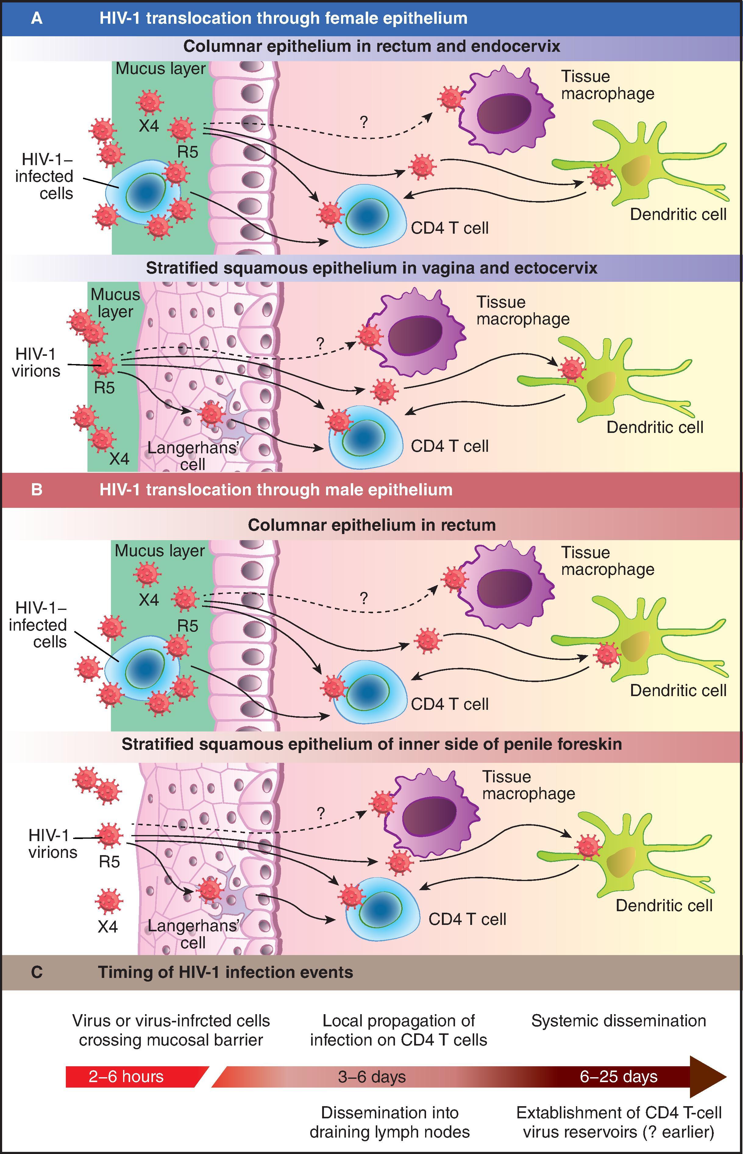 Fig. 31.5, Progression from HIV-1 transmission to productive clinical infection. HIV-1 must traverse several tissue layers in the female vagina or rectal mucosa to come into contact with appropriate receptive cells (Panel A) . The CCR5 (R5) viral strain has selective transmission advantages that remain poorly explained, and R5 variants make up the majority of transmitted and founder viruses. CXCR4 (X4) variants are transmitted only rarely (Panel B) . Virus–cell interactions in the male submucosa are likely to be similar to those in female submucosa, with viral targets including Langerhans’ cells, other submucosal dendritic cells, and CD4 cells (Panel C) . Dissemination into draining lymph nodes and the systemic circulation rapidly follows, with establishment of the CD4 T-cell viral reservoirs. (From Cohen MS, Shaw GM, McMichael AJ, Haynes BF. Acute HIV-1 infection. N Engl J Med. 2011;364:1943–1954.)