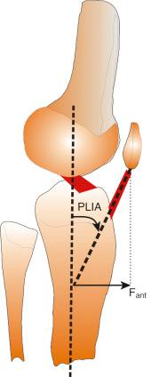 FIG 6-3, The line of action of the patellar ligament running from the posterior pole of the patella to the tibial tuberosity. The patellar ligament insertion angle (PLIA) is measured as the angle between the midshaft of the tibia and the line of action of the patellar ligament. With the knee in an extended position as shown, contraction of the quadriceps would transmit a relatively large anterior force (F ant ) to the proximal tibia.