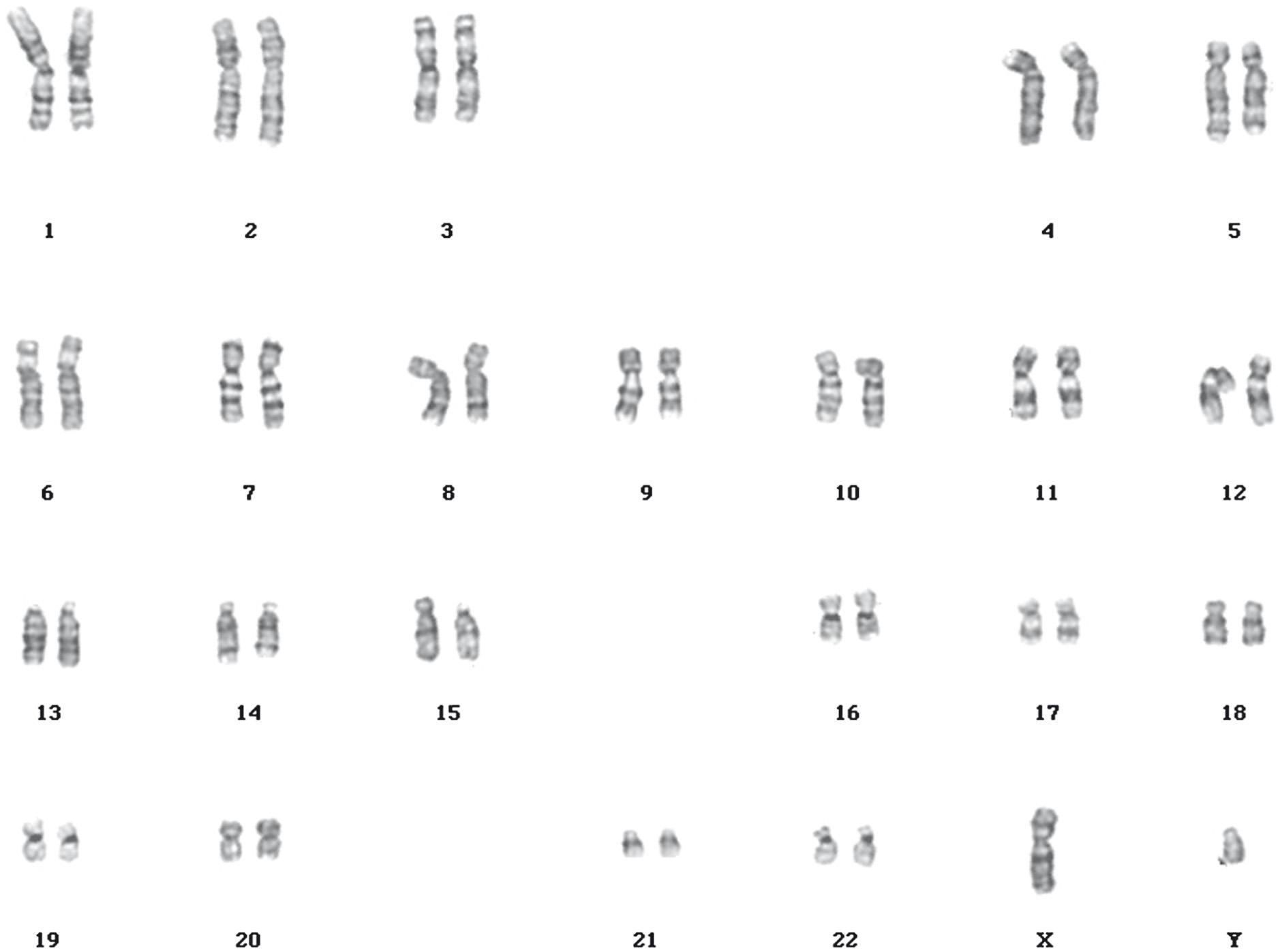 Fig. 5.2, Human chromosome karyotype.