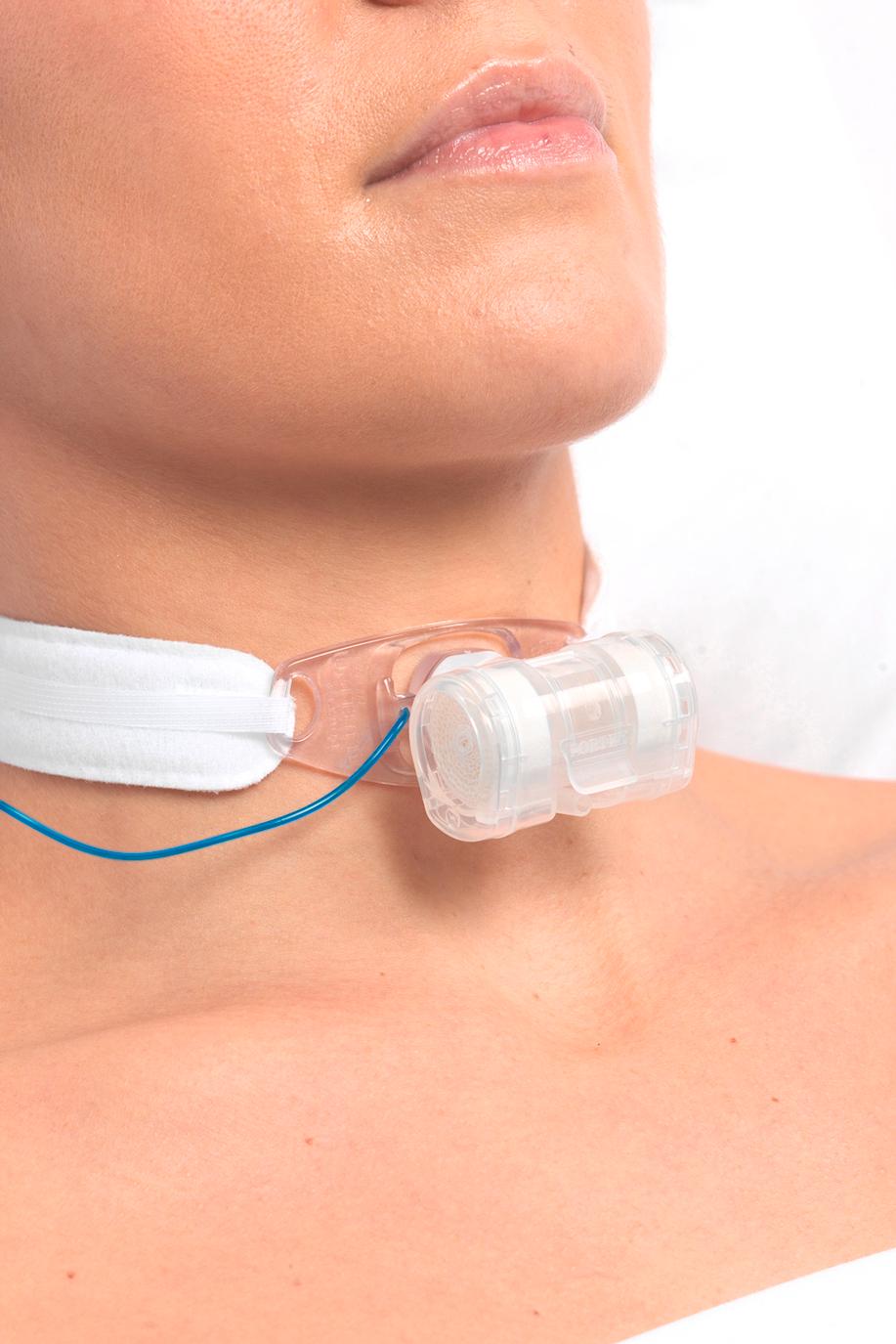 Fig. 9.2, The Thermovent T tracheostomy heat and moisture exchanger.