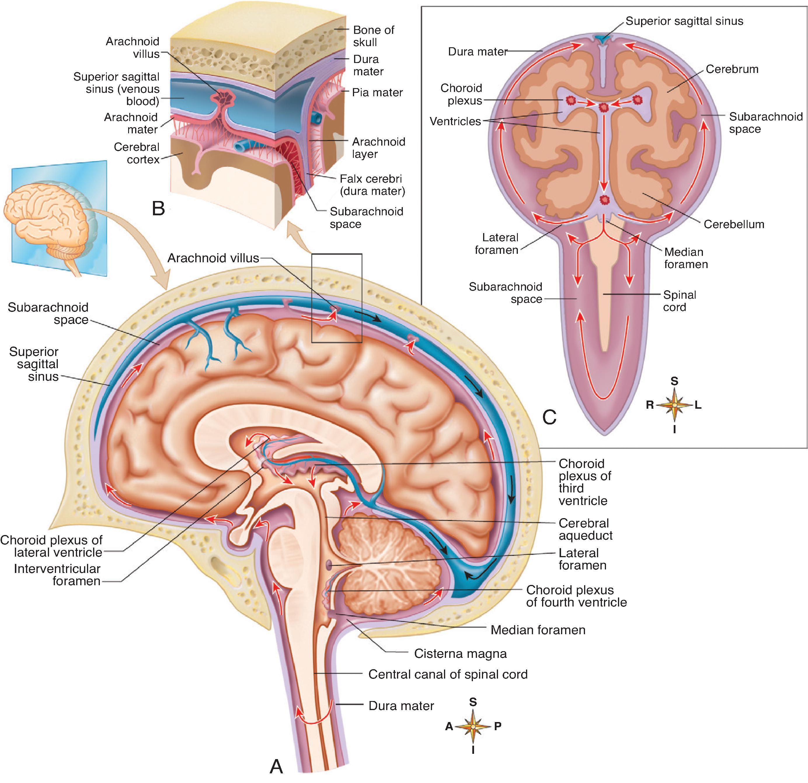 Fig. 11.1, Flow of Cerebrospinal Fluid . (A) Fluid produced by filtration of blood by the choroid plexus of each ventricle flows inferiorly through the lateral ventricles, interventricular foramen, third ventricle, cerebral aqueduct, fourth ventricle, and subarachnoid space and to blood. (B) Inset showing arachnoid villus, where CSF is reabsorbed into the blood of the superior sagittal sinus. (C) Simplified diagram showing flow of CSF. (From Patton KT. Anatomy and Physiology . 10th ed. Elsevier; 2019.)