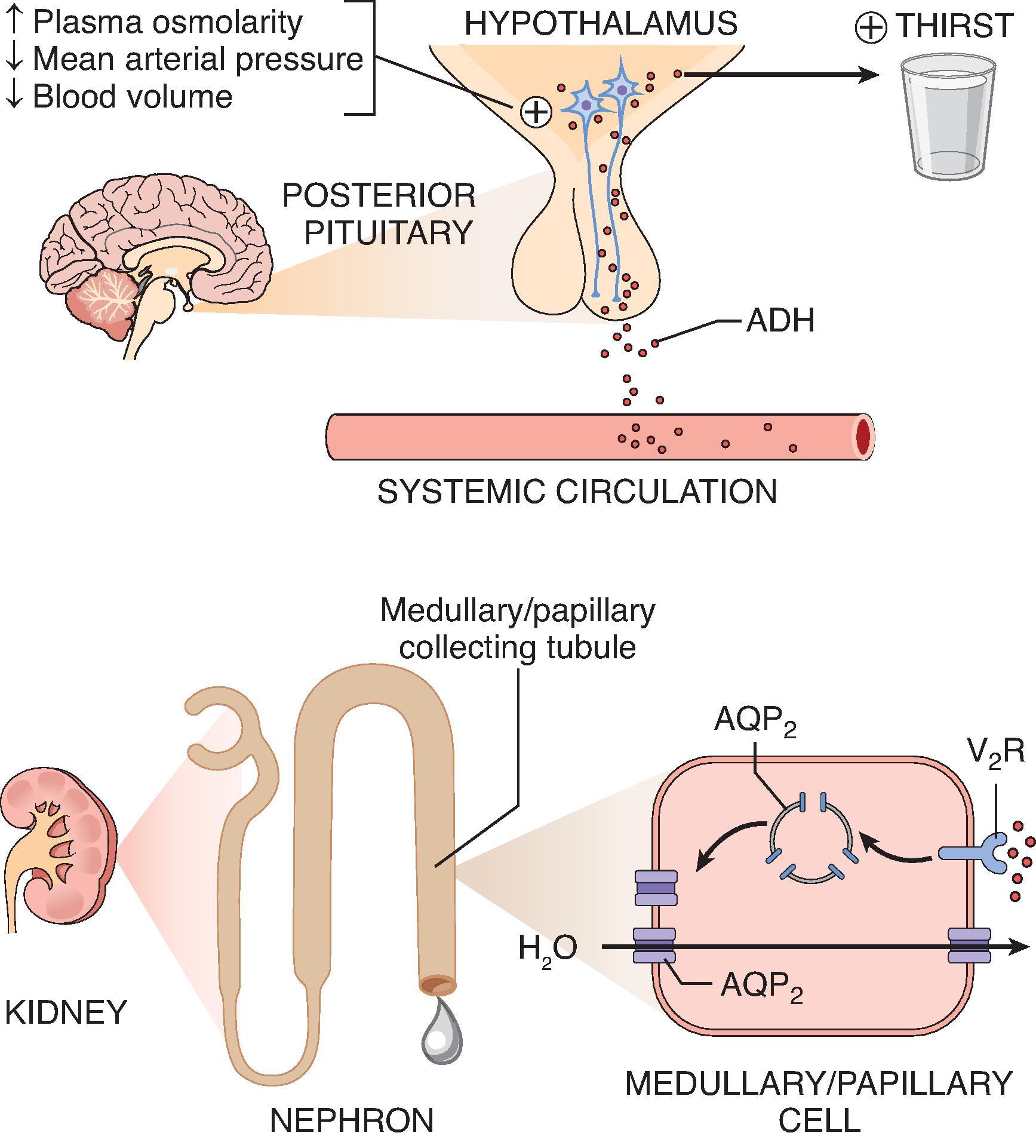 Fig. 8.3, ADH stimulus, release, and activity. ADH release is stimulated by an increase in plasma osmolality, decrease in mean arterial pressure, or decrease in blood volume. In hypernatremia, osmoreceptors in the hypothalamus directly stimulate the thirst mechanism while inducing ADH release from the posterior pituitary. ADH acts on the vasopressin type 2 (V 2 ) receptors in the medullary and papillary collecting ducts, upregulating AQP 2 channel production and insertion into the apical membrane, leading to increased water reabsorption from the tubular lumen. ADH, antidiuretic hormone; AQP 2 , aquaporin-2; V 2 R, vasopressin type 2 receptor.