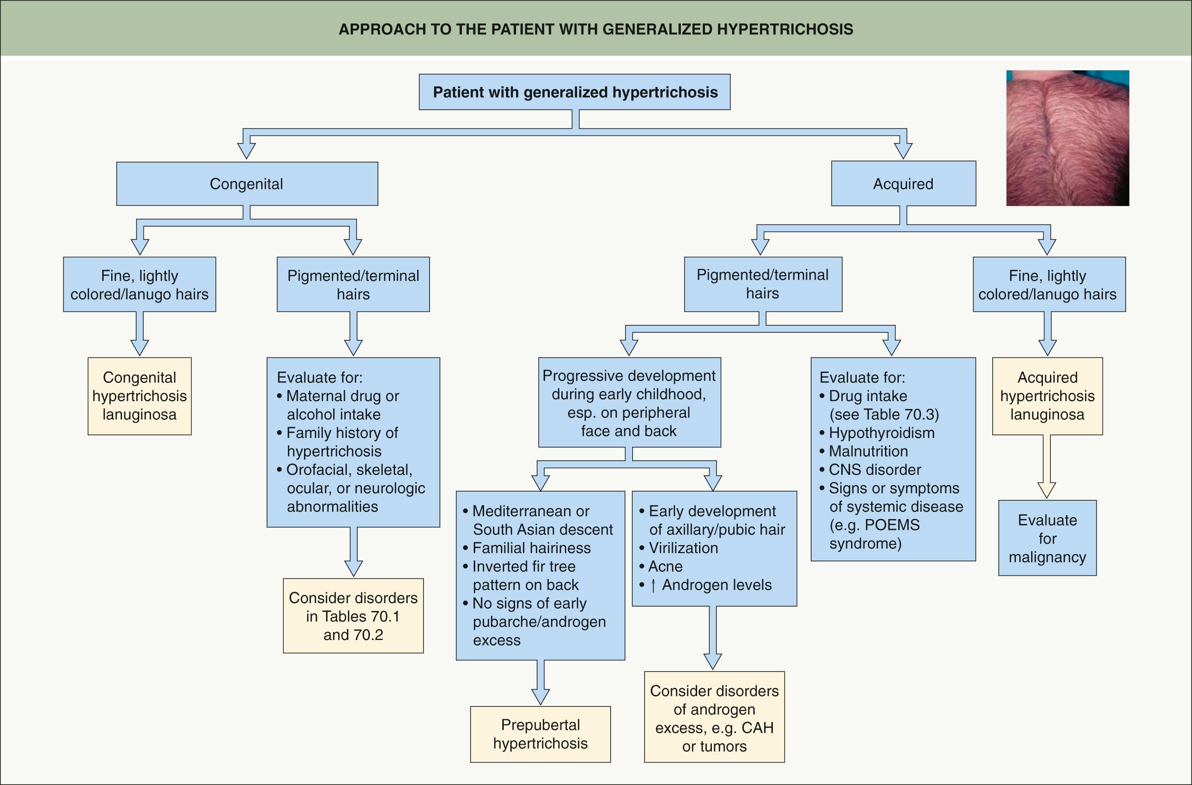 Fig. 70.1, Approach to the patient with generalized hypertrichosis.