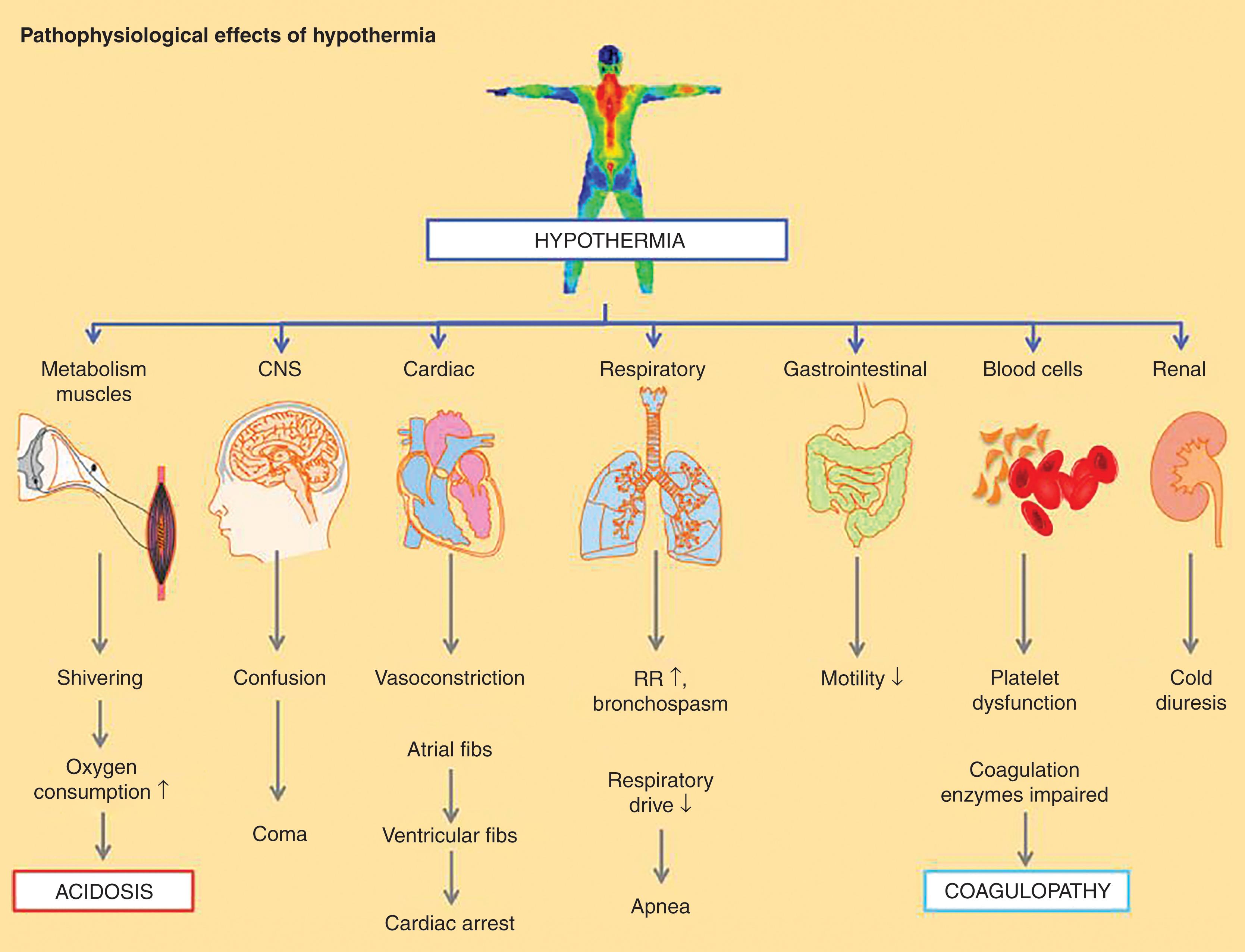 FIGURE 1, Pathophysiologic effects of hypothermia.