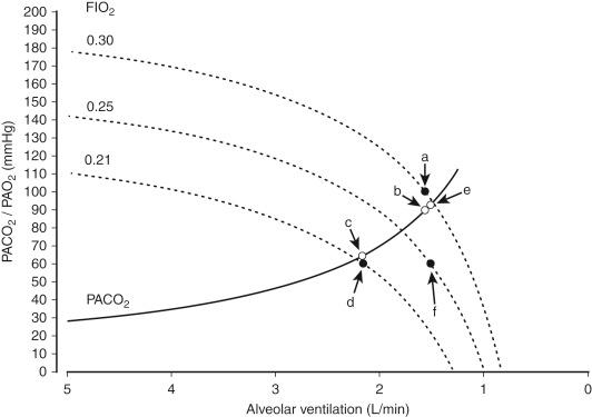 Fig. 192.2, Effect of supplemental O 2 on Pa o 2 in relation to Pa co 2 .