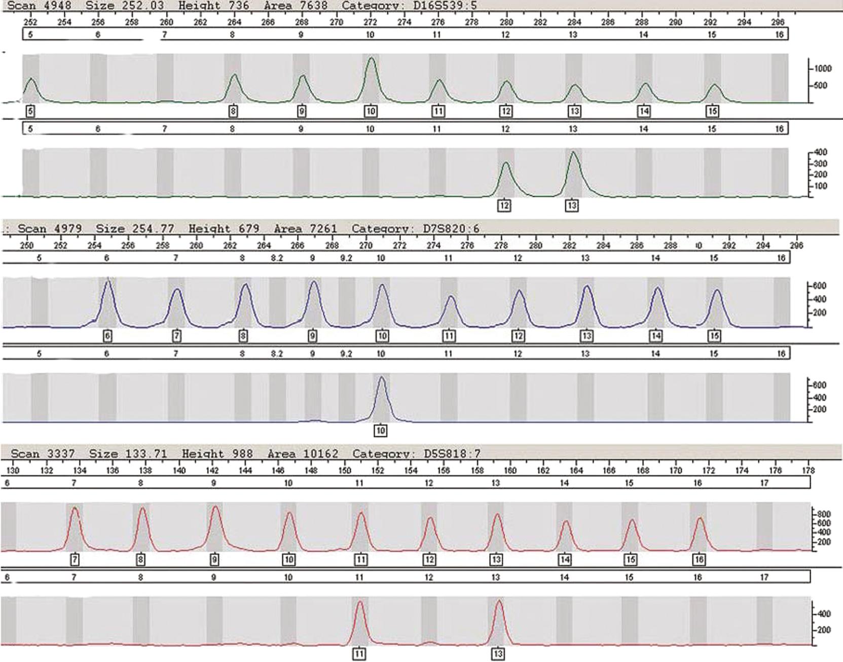 Fig. 74.2, The results of a sample electrophoresed on the ABI P rism 3100 Genetic Analyzer (Applied Biosystems) and amplified with the AmpFLSTR Identifiler PCR Amplification Kit. The ladders and accompanying results for three loci, D16S539 (alleles 12, 13), D7S820 (allele 10), and D5S818 (alleles 11, 13), are visualized in these images. The images demonstrate excellent resolution in the electrophoresis.