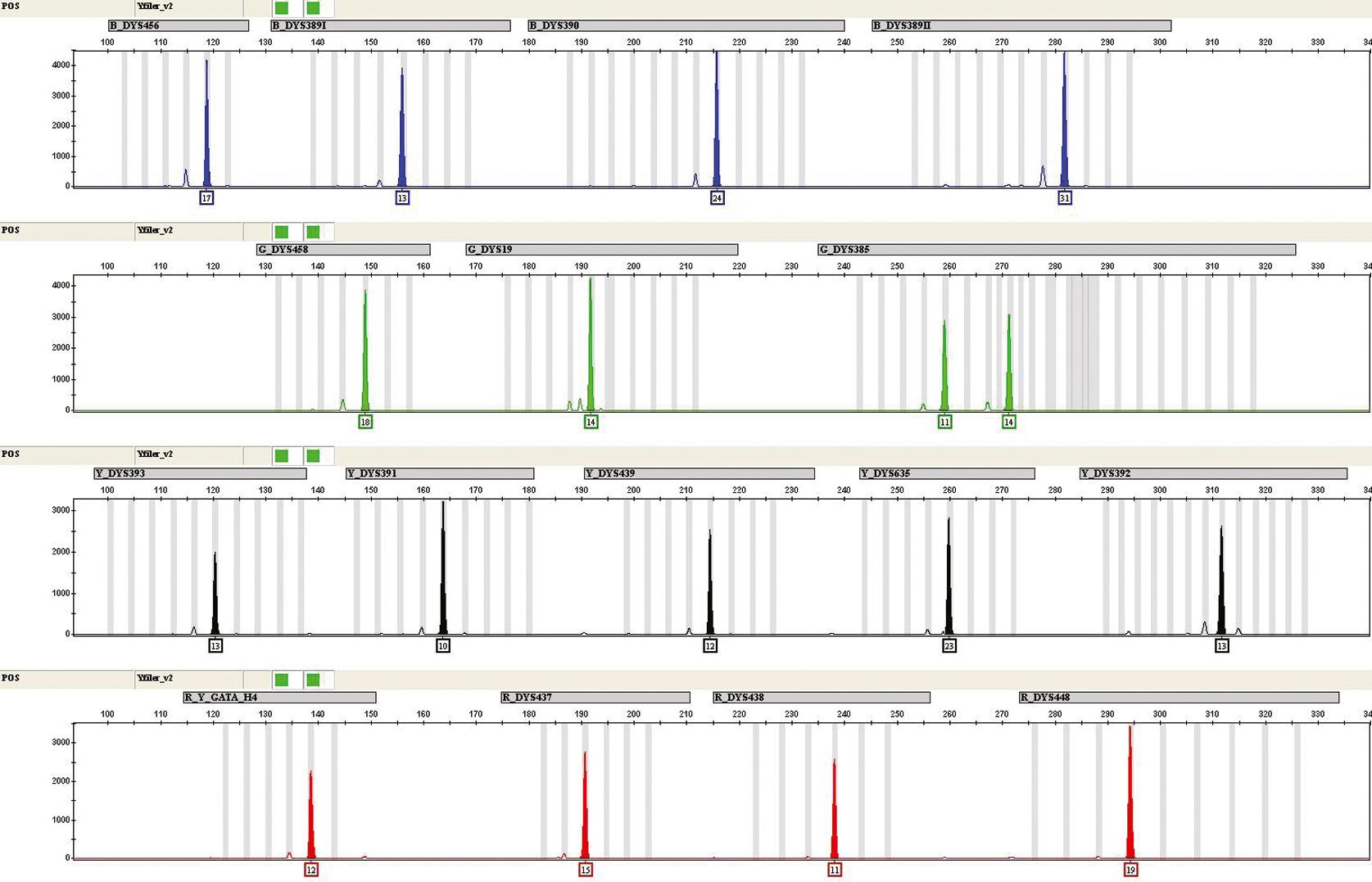 Fig. 74.3, The results of the kit-included positive control 9948 amplified with the AmpFLSTR Yfiler PCR Amplification Kit, electrophoresed on the ABI P rism 3130 xl Genetic Analyzer, and typed with GeneMapper ID Software v.3.1.2. The results for the 17 Y-STR loci are visualized. This image displays the phenotype of the positive control amplified in this mega-multiplex. The locus name is shown in the gray bar above the peaks; the allele call for each locus is just below the highlighted peak. (Applied Biosystems, Foster City, CA.)