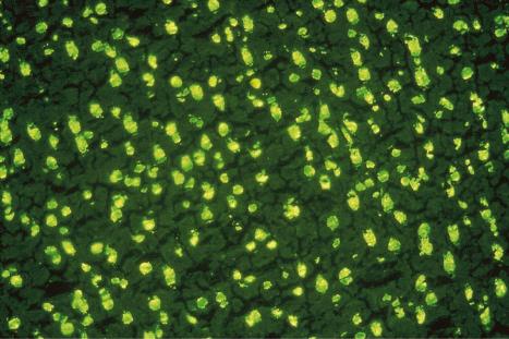 Fig. 17.38, Systemic lupus erythematosus: homogeneous antinuclear antibody in rat liver.