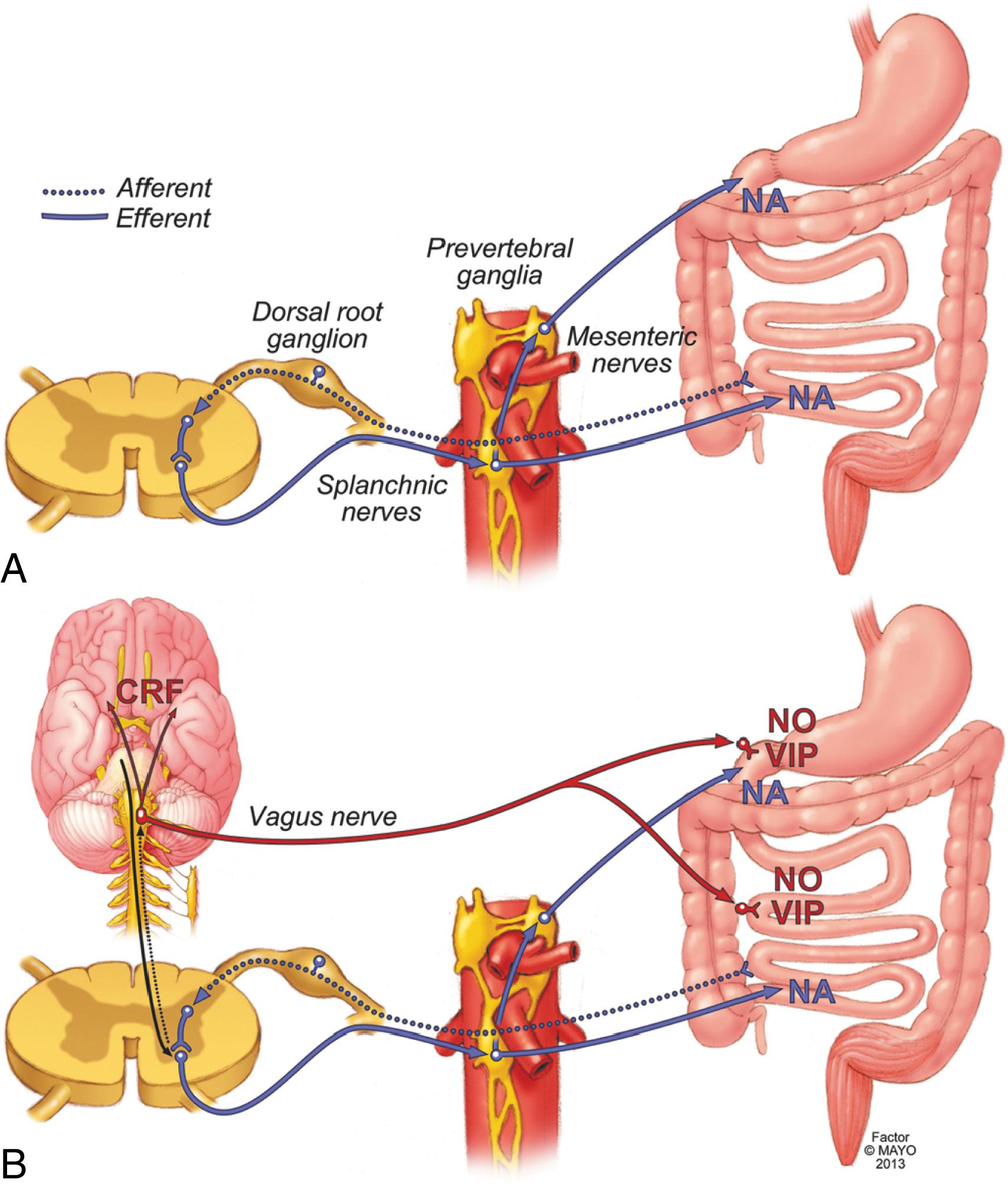 Fig. 124.1, Schematic representation of 2 neural pathways triggered by abdominal surgery. The intensity and nature of nociceptive stimuli determine the severity and duration of ileus. Simple laparotomy activates spinal afferents that synapse in the spinal cord where they activate an inhibitory pathway involving prevertebral adrenergic neurons that stops intestinal motility briefly (A). Intestinal manipulation activates additional pathways. Afferent signals are transmitted to the brainstem where they trigger increased autonomic output to the neurons of the intermediolateral column of the thoracic cord, where sympathetic preganglionic neurons that release noradrenaline (NA) are located. Activation of these nerves inhibits the entire GI tract (B). In addition to this adrenergic inhibitory pathway, intense stimulation of splanchnic afferents triggers a vagally-mediated pathway that synapses to inhibitory nitric oxide (NO) and VIP-containing neurons. VIP, vasoactive intestinal peptide.