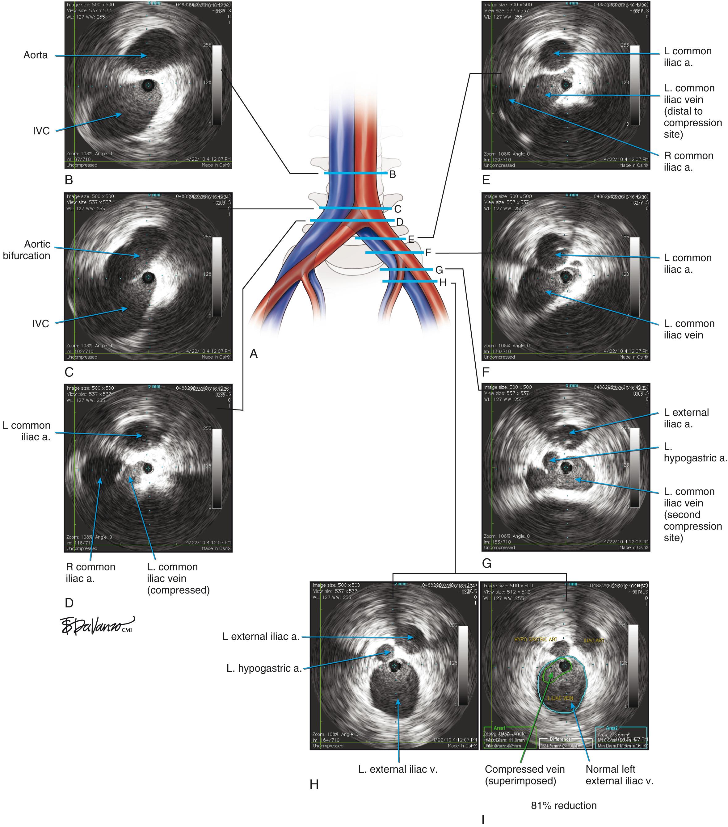 Fig. 18.4