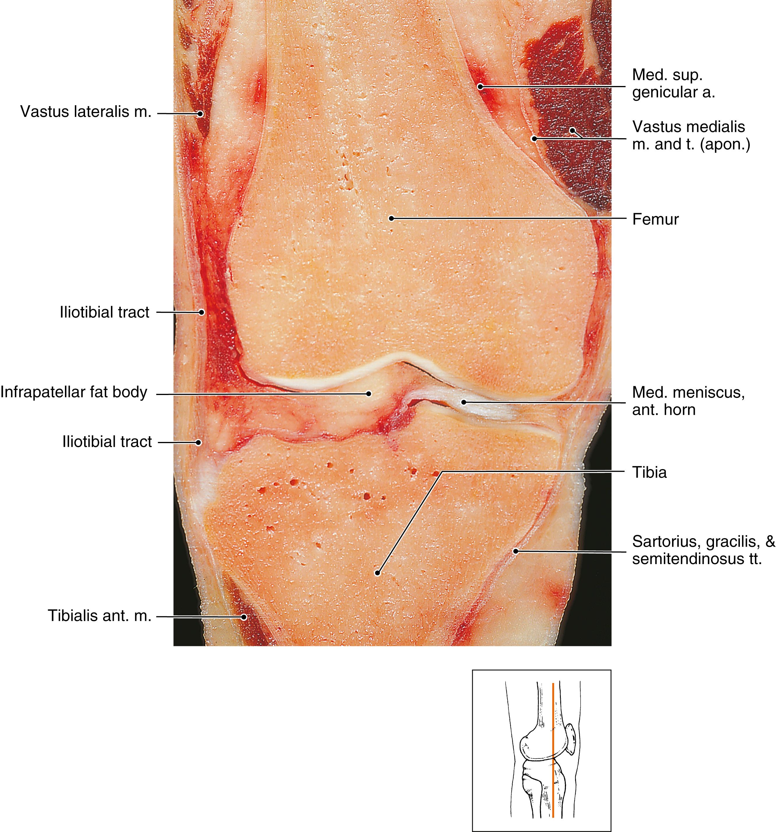 FIG. 162.3, Anatomy of the iliotibial band and adjacent structures. a., Artery; ant., anterior; apon., aponeurosis; m., muscle; med., medial; sup., superior; t. / tt., tendon/tendons.