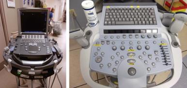 Fig. 7.10, A compact portable ultrasound machine. The machine is similar in size to a notebook computer (left image) . Fewer imaging options may be available with compact portable machines than with larger machines. A close-up view of the control panel of a slightly larger portable unit is shown (right image) . Physicians and technicians need to learn the functionality of the individual controls of the equipment used in their facility to optimize the image quality.