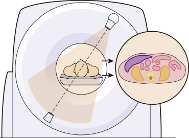 FIG 1-1, A CT image represents a cross section of the imaged subject rather than the x-ray shadow of the anatomy, as in a conventional radiograph.