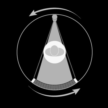 FIG 1-2, A simple CT scan produces a one-dimensional strip radiograph for each projection through the patient.