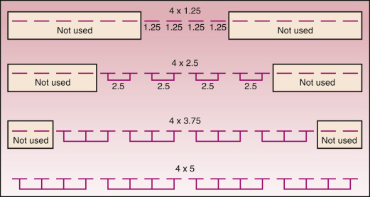 FIG 1-10, Matrix detector with 4-channel DAS. Electronic combination of individual 1.25-mm elements produces slice width configurations of 4 × 1.25 mm, 4 × 2.5 mm, 4 × 3.75 mm, or 4 × 5 mm.