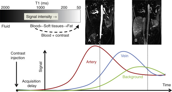 FIG 4-3, Timing diagram of a CE MRA exam. After intravenous contrast injection, the acquisition is delayed some time to allow for bolus arrival from the venous injection site to the arteries of interest. The mixing of the blood and the Gd-based contrast agent shortens the T1 of the blood considerably below the T1 relaxation times of the surrounding tissues. The bolus arrives in the arteries (red line), quickly followed by venous enhancement (blue line), and surrounding background tissue (green line). As shown during different CE MRA acquisitions in the thoracic descending aorta, short acquisition times and correct timing of the acquisition are vital in capturing the arterial window with peak enhancement ( A ). Delayed images ( B ) show decreased signal and contrast as well as venous signal. Note that both images have the same window/level.