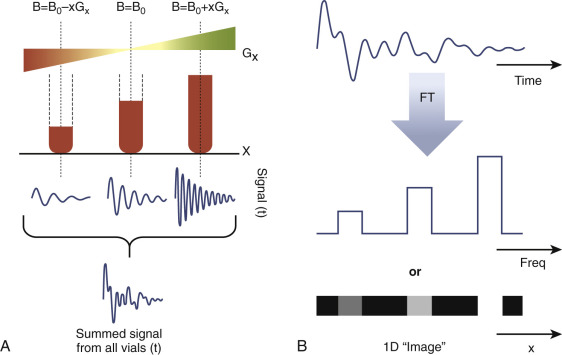 FIG 3-4, A, Three vials are filled with a liquid (red) and placed in an MRI scanner with a main magnetic field strength of B 0 . A magnetic field gradient, G x , which varies along the x-direction, is also applied; the net magnetic field at any position in space depends on the combined strength of both of these magnetic fields. After an RF pulse the magnetization in the left vial precesses slowly, the center vial moderately, and the right vial rapidly because of the different magnetic fields they experience. If signals in time were collected from each vial independently, these differences in precession rate would be seen, and differences in the amplitude of the signals would correspond to the amount of liquid at each of the spatial positions (middle). The summed signal (bottom) is what is actually collected by the MRI scanner. This type of encoding, where a gradient is played out during signal acquisition, is called frequency encoding. B, The summed MRI signal can be decomposed into separate frequencies using the Fourier transform. The time signal is converted into frequency units, which reflects the position of the vials. This can be represented as a 1D “image” where frequencies with high signal amplitude are bright and frequencies with low signal amplitude are dark.