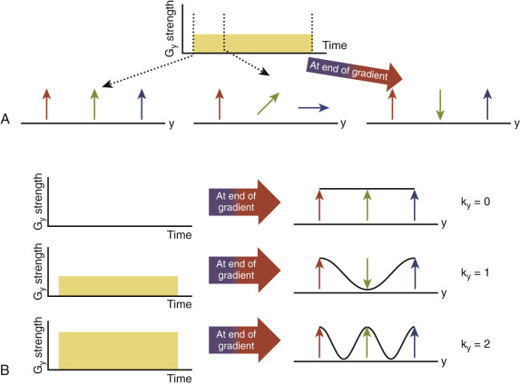 FIG 3-5, A, A phase-encoding gradient is applied along the y-direction, which causes spins in different locations in the y-direction to precess with different frequencies. When the gradient is turned off, the spins have a phase that is dependent on their position. This phase is retained when frequency encoding is applied in a direction orthogonal to the phase encoding. B, To collect different phase-encoding lines, phase-encoding gradients with different strengths are used. For k y = 0, no phase-encoding gradient is applied, and no y-position–dependent phase is imparted. For k y = 1, a gradient is applied with a strength and duration that leads to one period of a sinusoid across the field of view (FOV) in the y-direction. For k y = 2, the gradient area is twice that for k y = 1, and the phase variation of the magnetization over the FOV covers two periods.