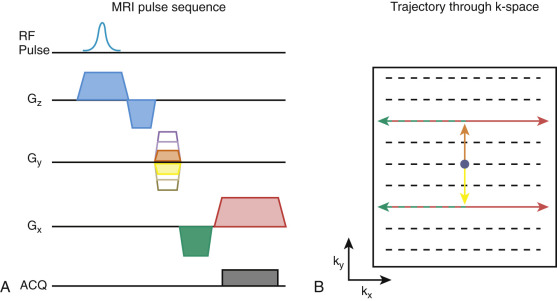 FIG 3-6, A, Schematic of an MRI pulse sequence, where the RF pulse and slice select gradients are shown in blue, the phase-encoding gradients in yellow and orange, the read dephasing gradient in green, the frequency encoding gradient in pink, and the acquisition window in gray. B, Each gradient is used to “move” around in k-space. After slice selection, no spatial encoding has yet been performed, and the location in k-space is denoted with the blue dot (center). The phase-encoding gradient enables motion up and down in k-space (orange and yellow arrows), the read dephasing gradient causes motion to the left (green arrow) , and the frequency encoding gradient to the right (red arrow). If data are collected during the frequency encoding gradient, the result is a line of k-space data.