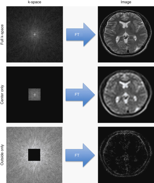 FIG 3-7, Top, An example of fully sampled k-space (left) and the corresponding image (right). Middle, If only the center portion of the k-space is collected, the resulting image has a lower resolution but shows the overall image contrast. Bottom, The outer portions of k-space correspond to the high-resolution details of the image.