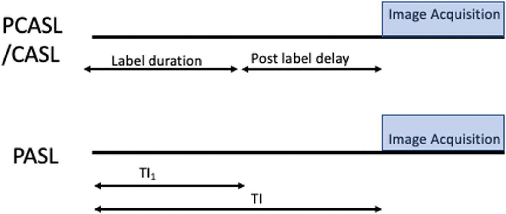 Fig. 22.3, Arterial Spin Label Perfusion: Sequence design. PCASL/CASL employs a labeling pulse over a set duration followed by a PLD after which image acquisition (readout) is performed.