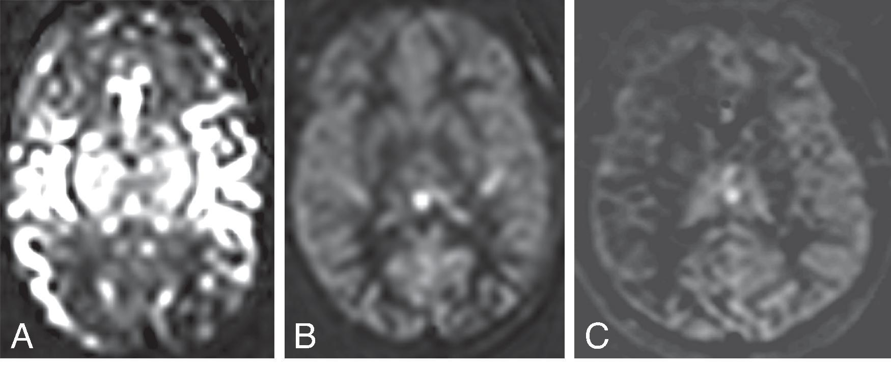 Fig. 22.4, ASL.