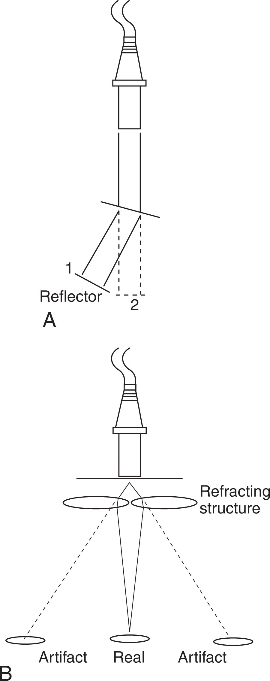 Fig. 7.9, Refraction (A) results in improper positioning of a reflector on the display. The system places the reflector at position 2 (because that is the direction from which the echo was received). The reflector is at position 1. (B) One real structure is imaged as two artifactual objects because of the refracting structure close to the transducer. A triple presentation (one correct, two artifactual) will result if unrefracted pulses can propagate to the real structure.