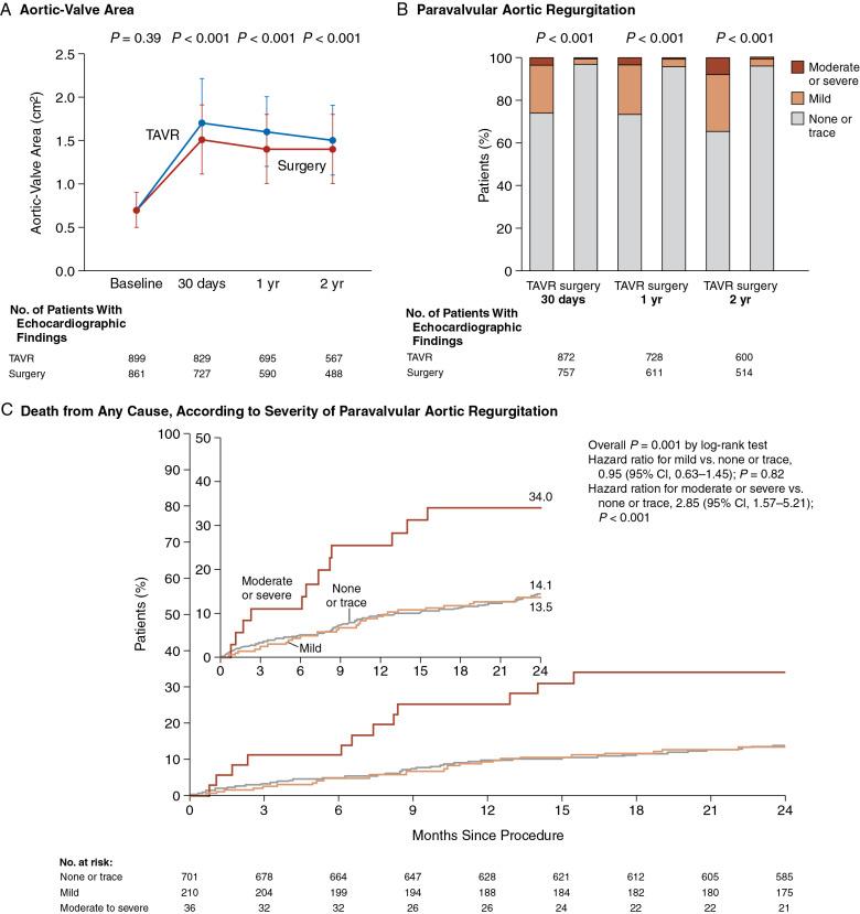 Fig. 13.2, Echocardiographic Findings for Intermediate-Risk Patients Undergoing Transcatheter Aortic Valve Replacement (TAVR) .