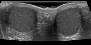 Fig. 72.7, Normal Testes.