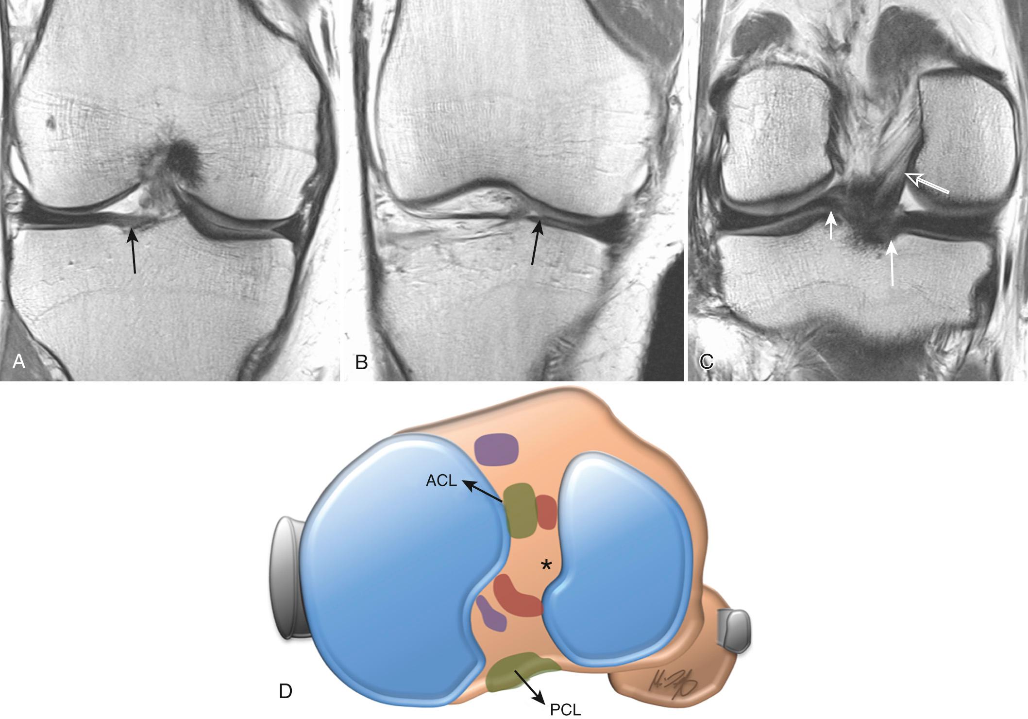 FIG 7.3, Normal Anatomy of the Root Ligaments