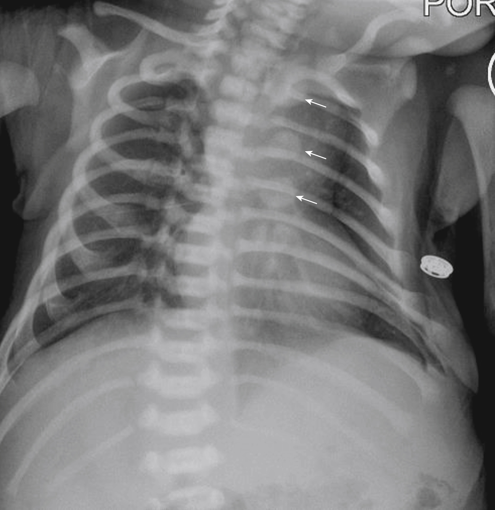 Fig. 19.3, Sternal ossification centers.