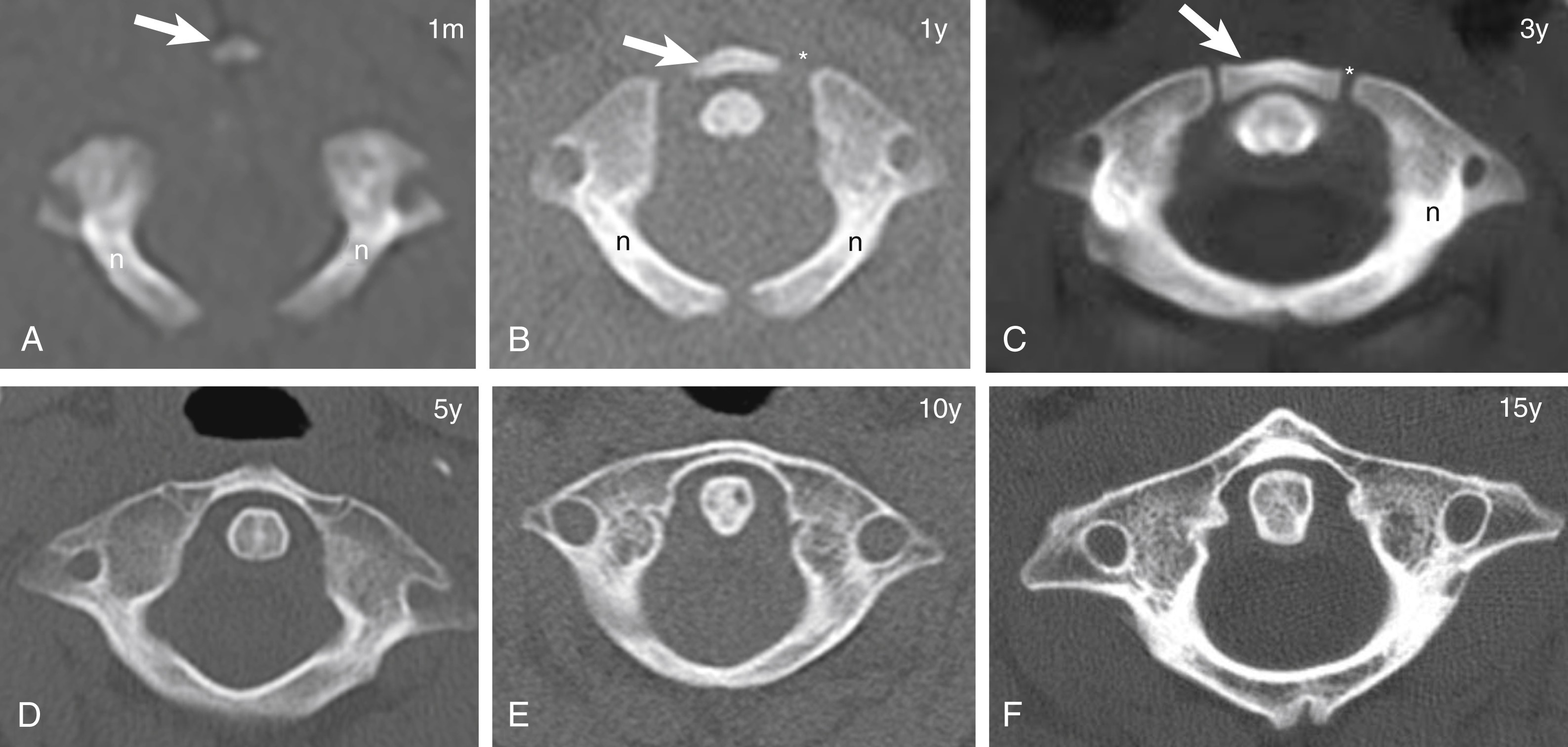 Fig. 28.3, C1 development.