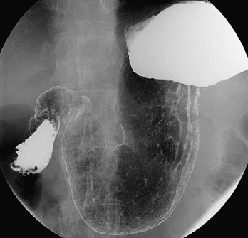 Figure 19-2, Supine view.