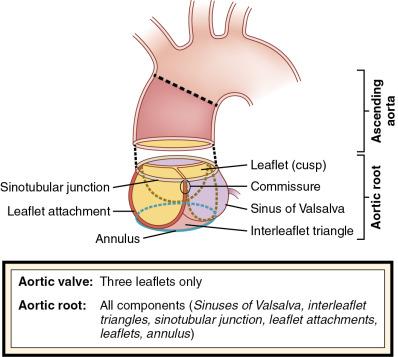 Fig. 8.1, Proposed Terminology of the Aortic Root Components.