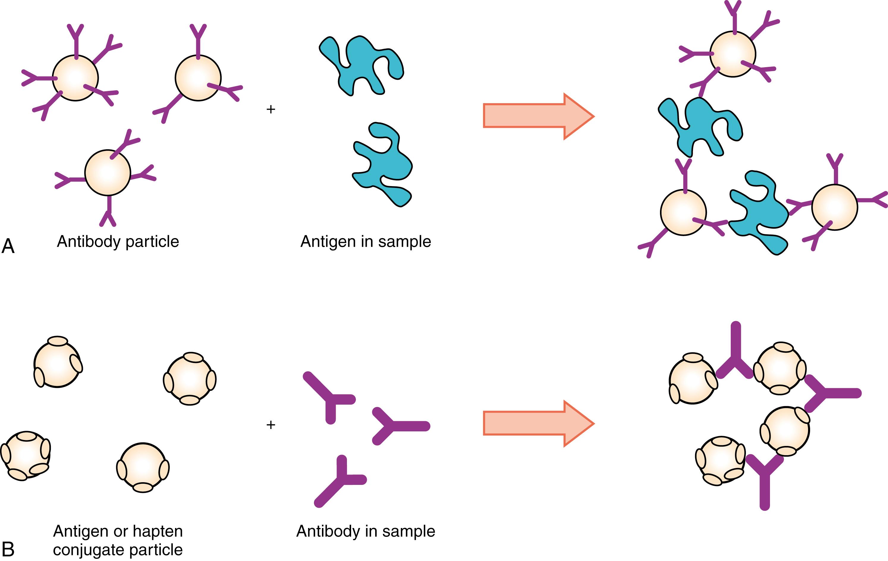 Figure 45.3, Principles of passive particle agglutination immunoassay for detection of antigen with multiple A, epitopes or B, antibodies.