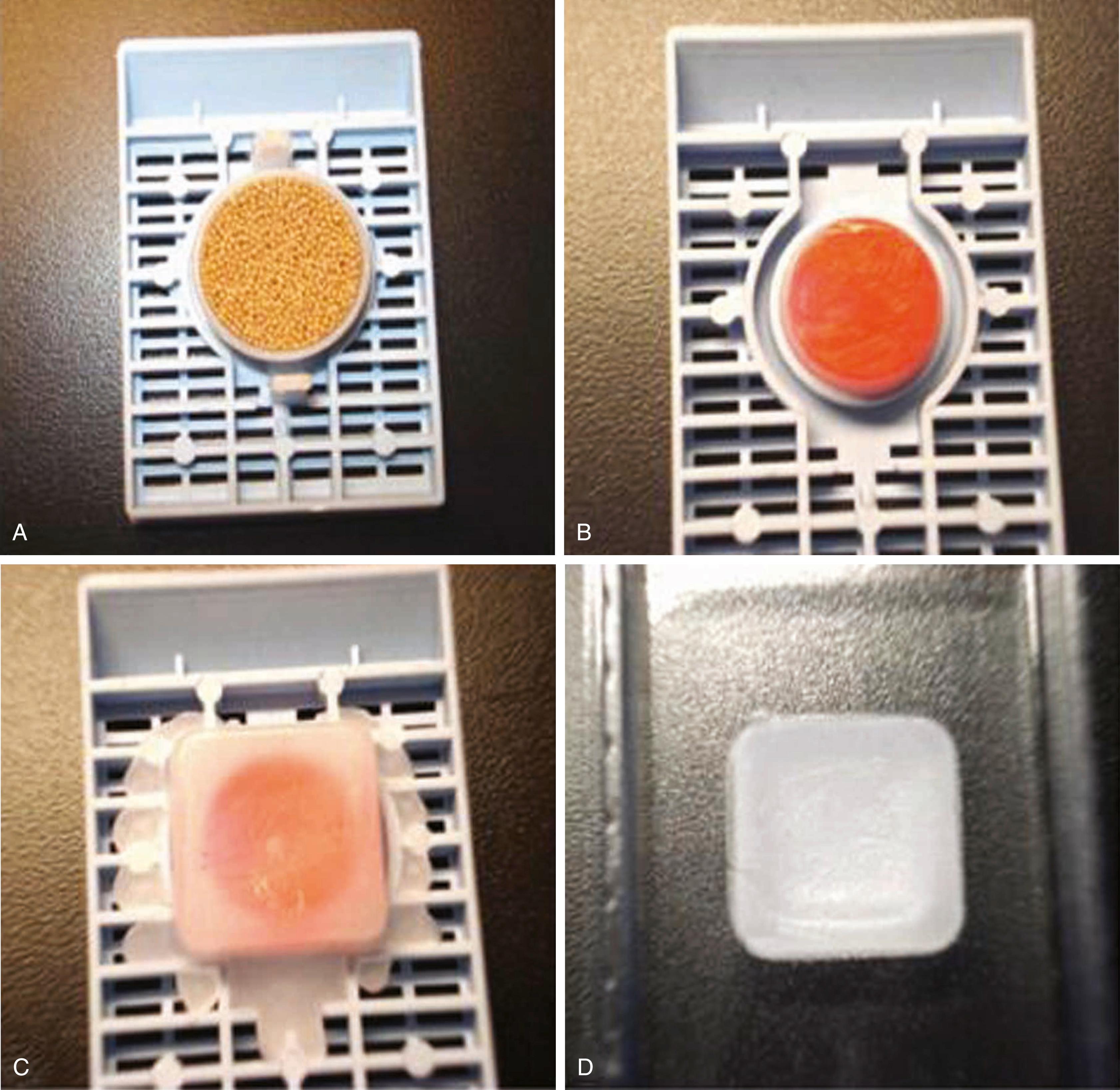 Fig. 21.3, Cellient automated cell block system. (A) Tissue cassette with filter: sample collected on cassette. (B) Tissue cassette with filter: sample embedded in paraffin. (C) Additional layering of paraffin during processing in finishing station. (D) Finishing station for easy sectioning.