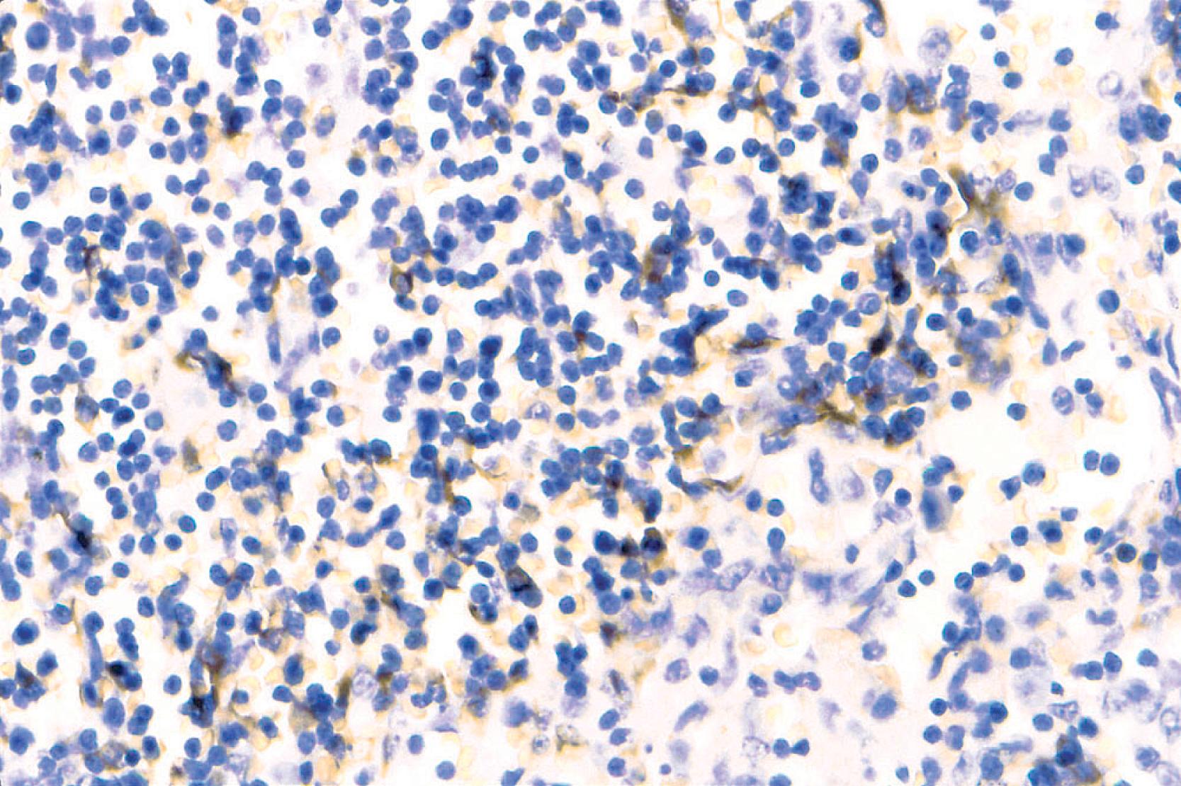 Fig. 8.10, In this normal lymph node, interfollicular dendritic cells are CAM5.2+.