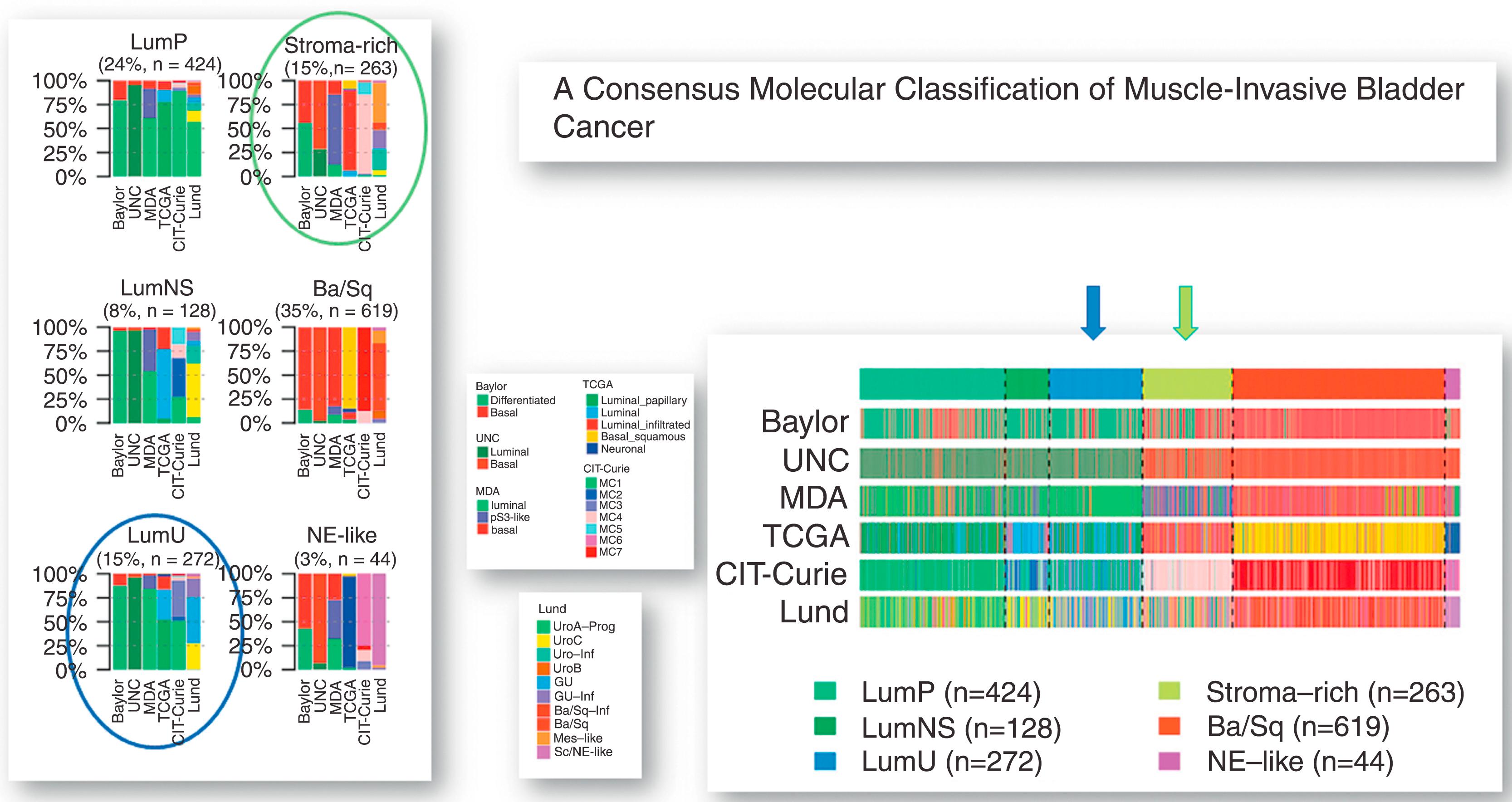 Fig. 17.16, “Consensus Molecular Classification of Muscle Invasive Bladder Cancer” proposed in 2020, by a team of international multidisciplinary experts in an attempt to reconcile six previously published classification schemes. The consensus includes six molecular classes: luminal papillary (LumP), luminal nonspecified (LumNS), luminal unstable (LumU), stroma-rich (stroma-rich), basal/squamous (Ba/Sq), and neuroendocrine-like (“NE”-like). The classes differ in underlying oncogenic mechanisms, in their infiltration by associated Tumor immune microenvironment (immune and stromal cells), and histologic and clinical characteristics features and outcomes. MDA, MD Anderson Cancer Center; MIBC, muscle-invasive bladder cancer; TCGA, the Cancer Genome Atlas; UNC, University of North Carolina.