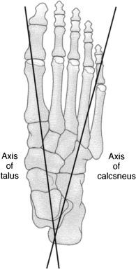 Fig. 2.1, Axis of talus versus axis of os calcis.