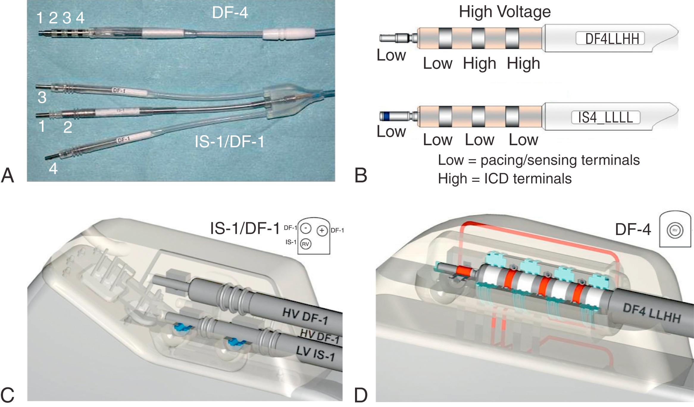 Fig. 121.1, DF-4/IS-4 lead design.