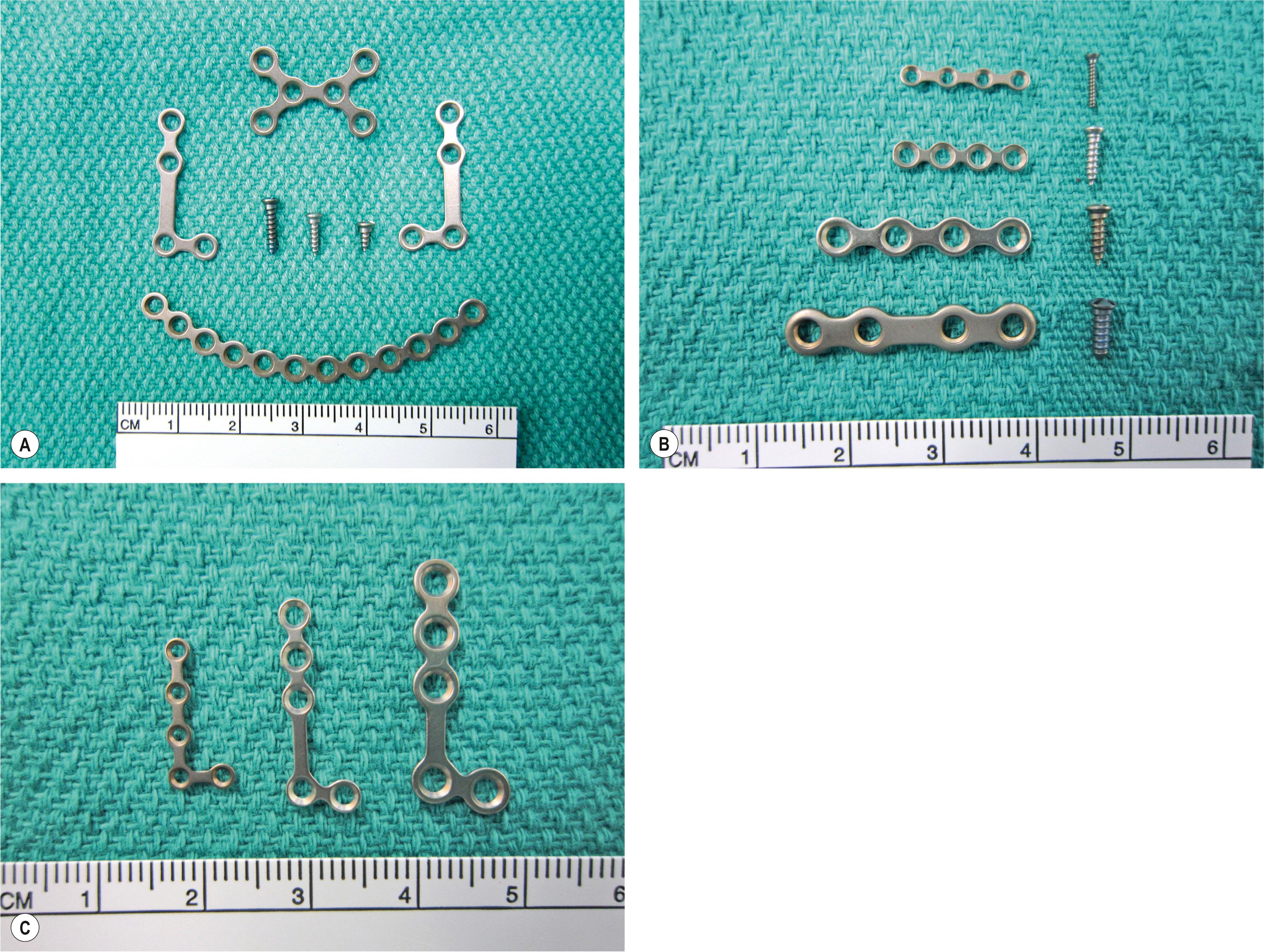 Figure 31.1, Titanium plates for midface reconstruction. (A) Various 2.0-mm plates and screws. The screws are 7, 5, and 3 mm in length (left to right). (B) Four-hole plates and screws for the 1.0-, 1.5-, 2.0-, and 2.3-mm plating systems. (C) A 1.0-, 1.5-, and 2.0-mm “L” plate. The screws are all 5 mm in length. Note that, by convention, the size of the plates is based upon the screw diameter.