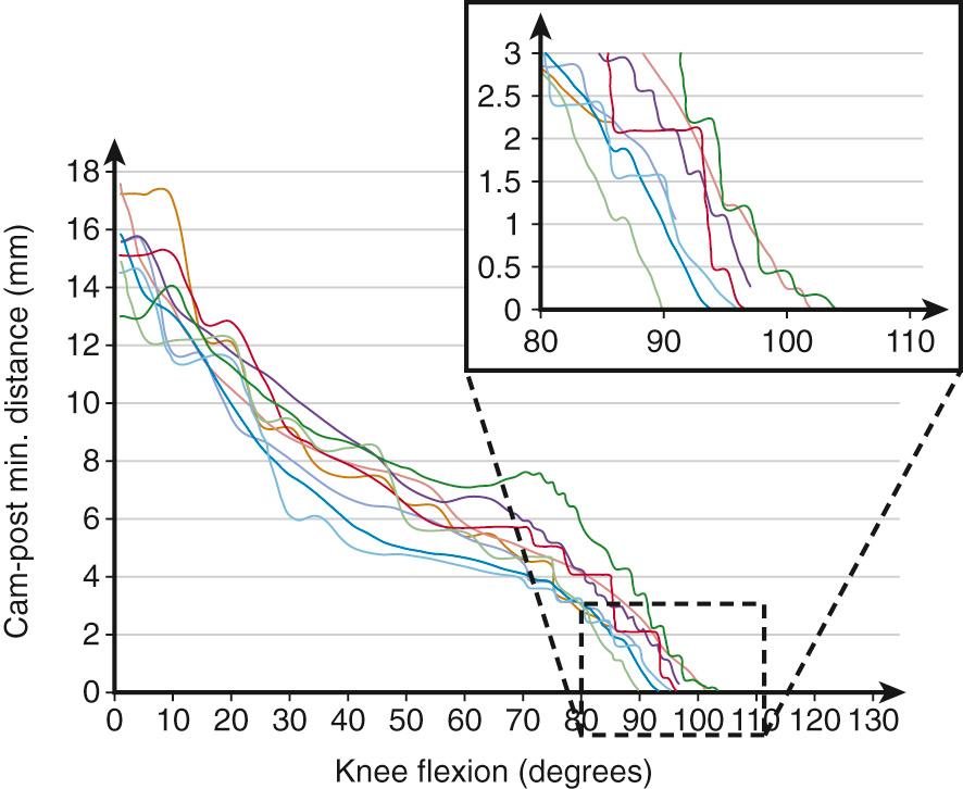 FIG 21.3, Minimum distances between the cam and post for mobile-bearing subjects were calculated during DKB activity.