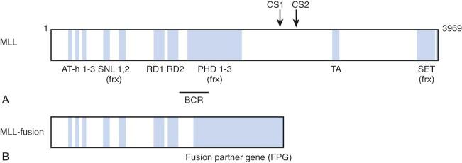 Figure 52-1, Schematic representation of the mixed-lineage leukemia (MLL) protein and MLL fusions. A , The MLL gene is approximately 89 kb long, consists of 37 exons, and encodes a 3969–amino acid nuclear protein with a complex domain structure (unique domains are highlighted). The N-terminus contains three short AT hook motifs (AT-h 1-3) , which are thought to mediate binding to the minor groove of AT-rich genomic deoxyribonucleic acid (DNA) sequences. There are two nuclear localization sites (SNL1 and SNL2) immediately C-terminal to the AT hooks that are followed by a transcriptional repression domain (RD) consisting of two functional subunits, RD1 and RD2. RD1 contains a DNA methyltransferase homology domain. The plant homeodomains (PHD) zinc finger motifs may mediate binding to a number of different proteins or to chromatin. The transcriptional activation (TA) domain recruits the transcriptional coactivator CREB-binding protein and precedes a C-terminal Su(var)3-9, Enhancer of Zeste, Trithorax (SET) domain that possesses histone H3 lysine 4 (H3K4) methyltransferase activity. The breakpoint cluster region (BCR) spans exons 8 to 13. B, Structure of MLL fusion proteins generated by MLL translocations. A typical MLL fusion protein contains the N-terminus of MLL encoded by the first 8 to 13 exons and the C-terminus of one of more than 50 fusion partners. CS, Cleavage site.