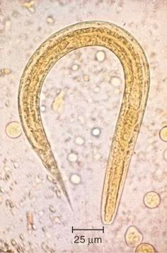 Fig. 2.21, Rhabditiform larva of Strongyloides stercoralis in faeces.